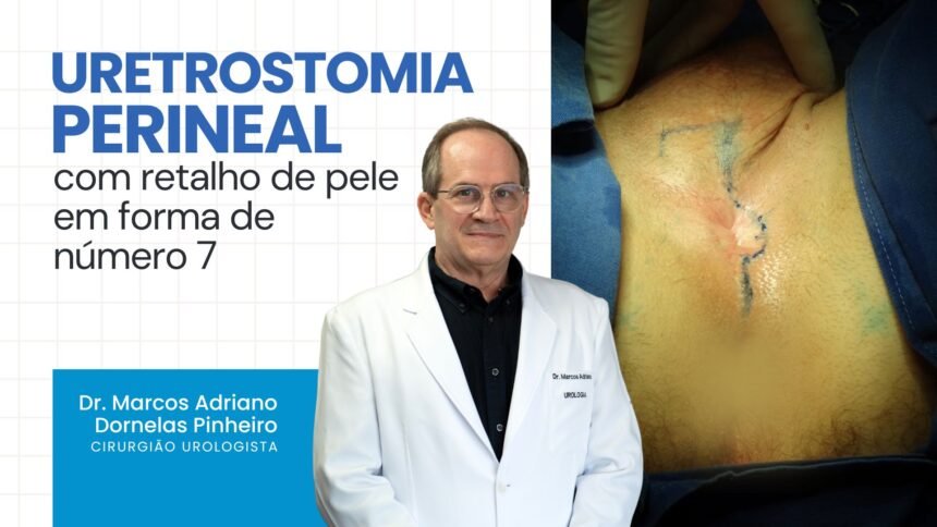 Uretrostomia perineal com retalho em número “7”