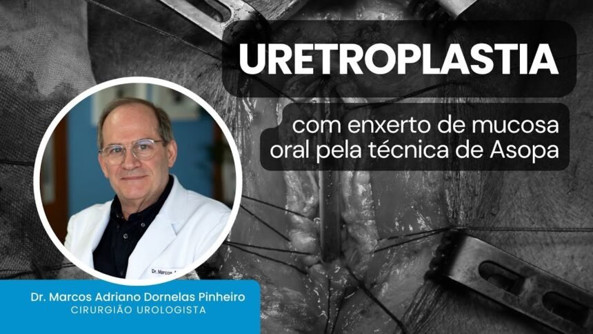 Uretroplastia com enxerto de mucosa oral pela técnica de Asopa