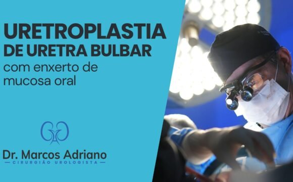 Uretroplastia de uretra bulbar com enxerto de mucosa oral