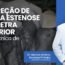 Correção de longa estenose de uretra anterior pela técnica de Kulkarni