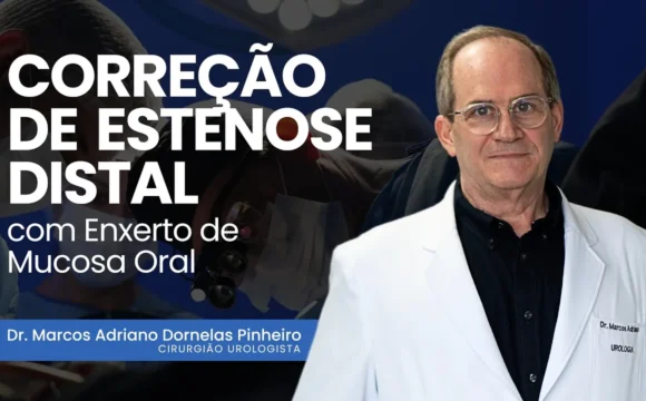 Correção de Estenose de Uretra Distal com Enxerto de Mucosa Oral em Tempo Único