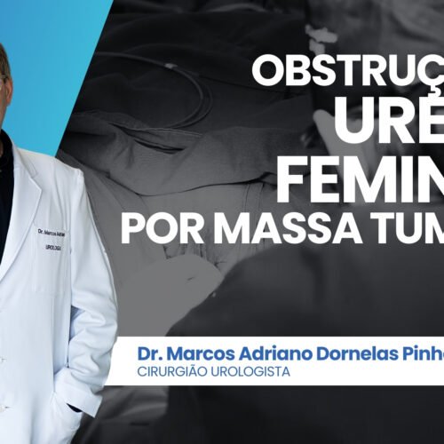 Obstrução da uretra feminina por massa tumoral – diagnóstico e achados do exame anátomo-patológico