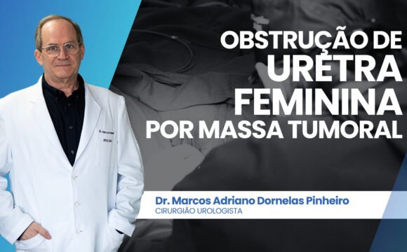 Obstrução da uretra feminina por massa tumoral – diagnóstico e achados do exame anátomo-patológico