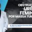 Obstrução da uretra feminina por massa tumoral – diagnóstico e achados do exame anátomo-patológico