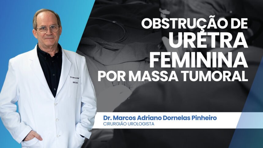 Obstrução da uretra feminina por massa tumoral – diagnóstico e achados do exame anátomo-patológico