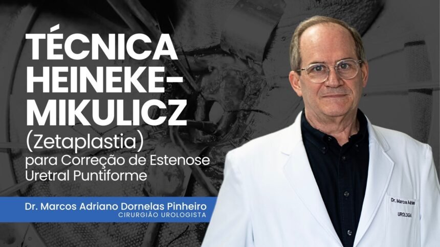 Técnica Heineke-Mikulicz (Zetaplastia) para Correção de Estenose Uretral Puntiforme