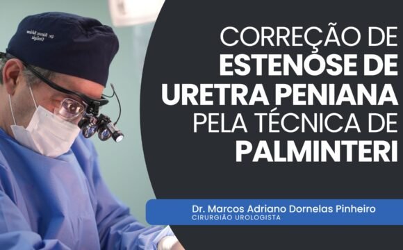 Correção de estenose de uretra peniana pela técnica de Palminteri