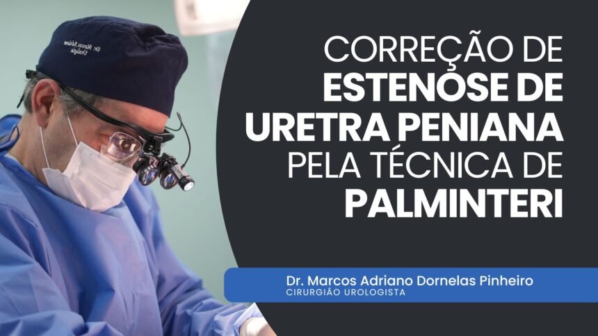capa madp youtube (6) Correção de estenose de uretra peniana pela técnica de Palminteri