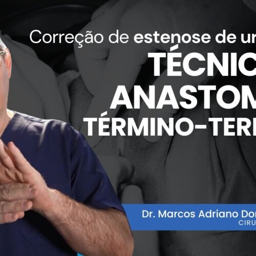 Correção de estenose de uretra pela técnica de anastomose término-terminal