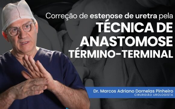 Correção de estenose de uretra pela técnica de anastomose término-terminal