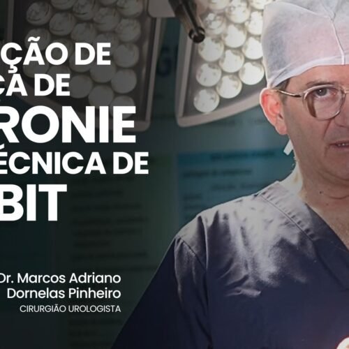 Correção de doença de PEYRONIE pela técnica de NESBIT