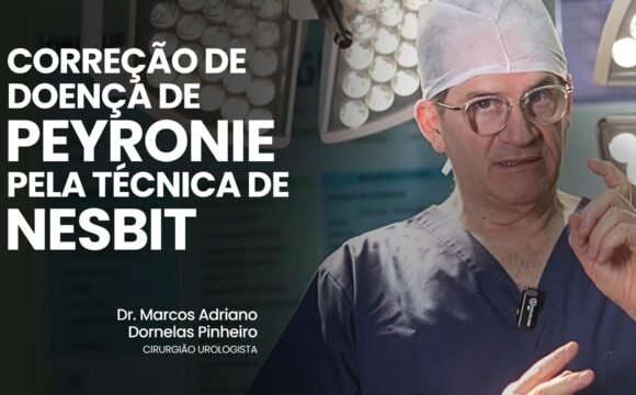 Correção de doença de PEYRONIE pela técnica de NESBIT