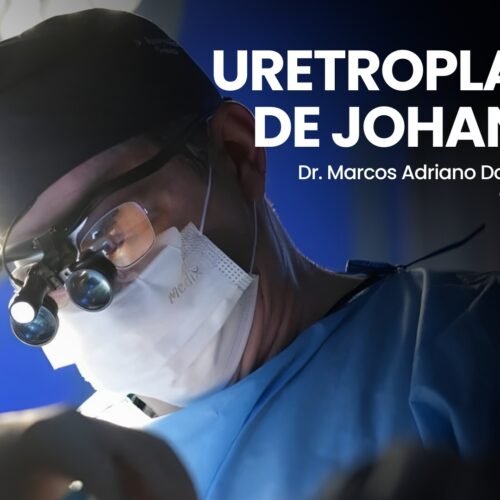capa madp youtube (5) Uretroplastia em estenose uretral complexa – técnica de Johanson