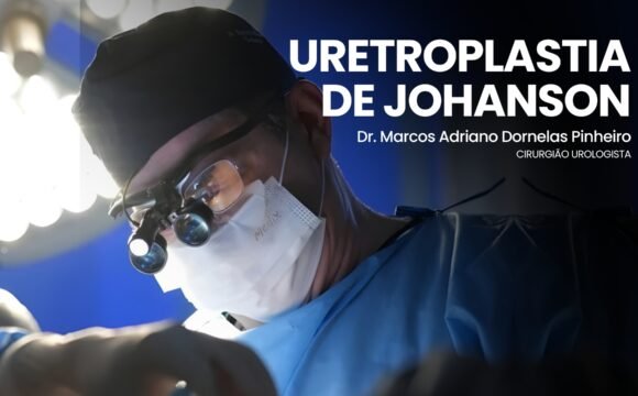 capa madp youtube (5) Uretroplastia em estenose uretral complexa – técnica de Johanson