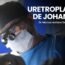 Uretroplastia em estenose uretral complexa – técnica de Johanson