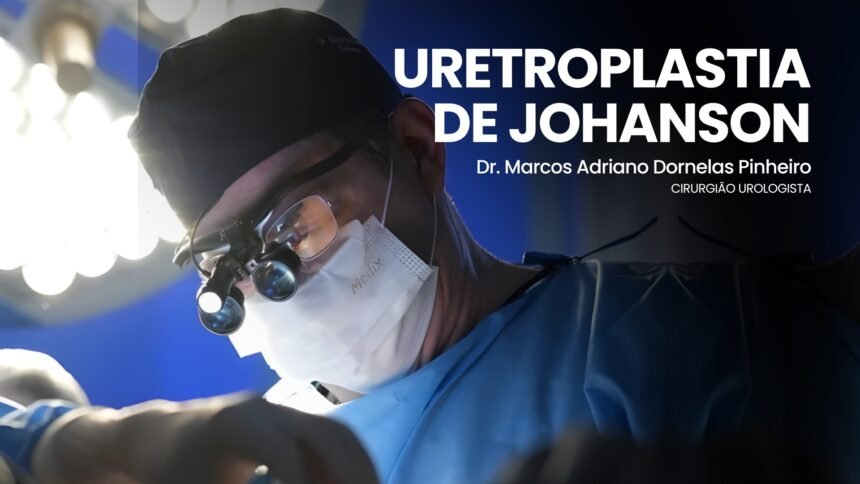 Uretroplastia em estenose uretral complexa – técnica de Johanson