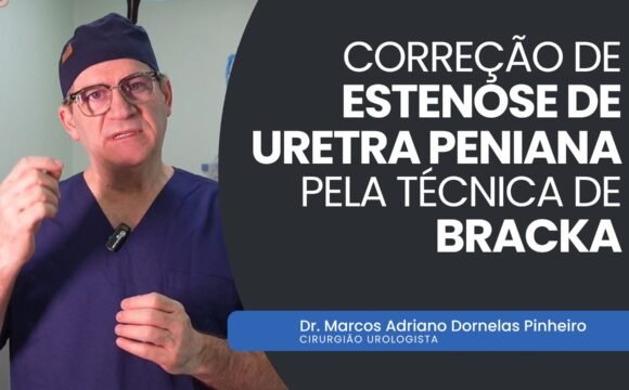Cirurgia Urológica Correção de Estenose pela Técnica de Bracka