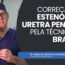 Cirurgia Urológica Correção de Estenose pela Técnica de Bracka