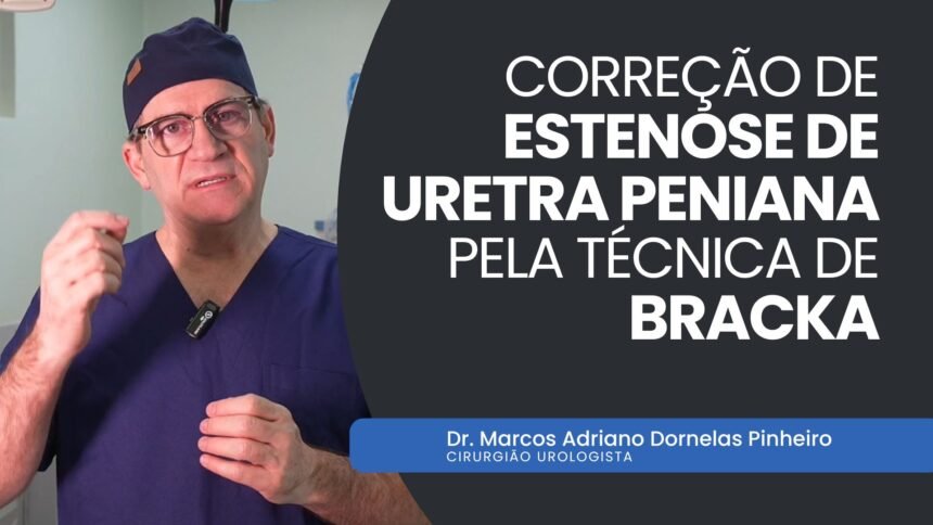 Cirurgia Urológica Correção de Estenose pela Técnica de Bracka